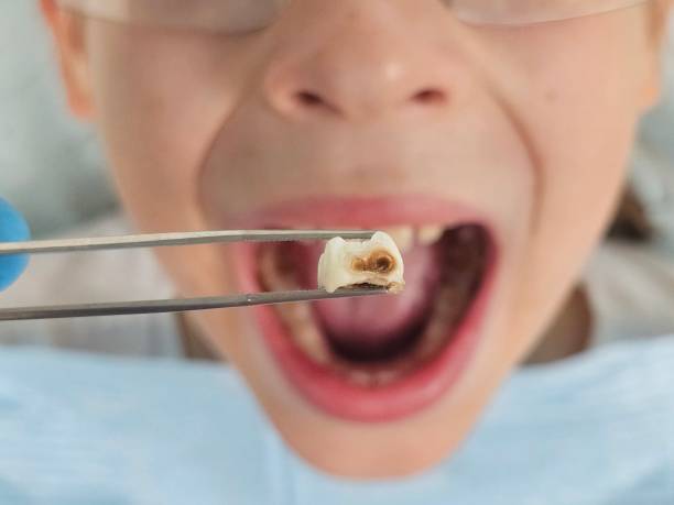 Best Emergency Denture Repair in Potomac Park, CA