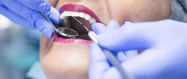 Best Emergency Dental Care for Broken or Chipped Teeth in Potomac Park, CA